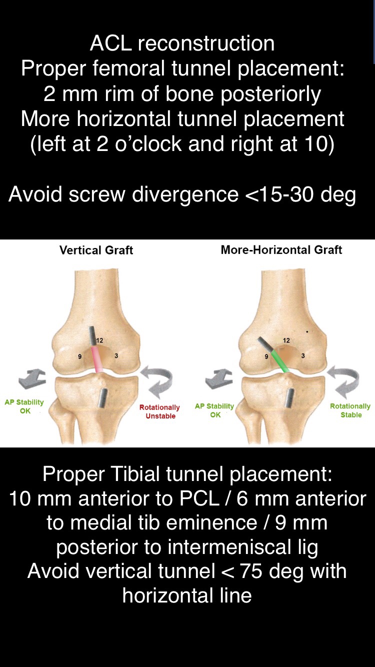 ACL and PCL – Let's Talk Ortho